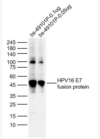 Anti-HPV16 E7  antibody-人乳头瘤病毒16型E7抗体,HPV16 E7