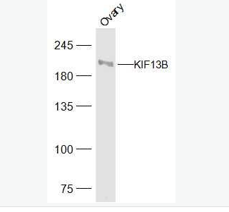 Anti-KIF13B  antibody-驱动蛋白家族蛋白13B抗体,KIF13B