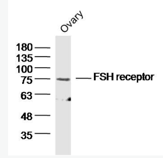 Anti-FSH receptor antibody-促卵泡刺激素受体抗体,FSH receptor