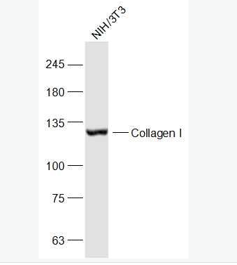 Anti-Collagen I antibody-I型胶原蛋白抗体,Collagen I