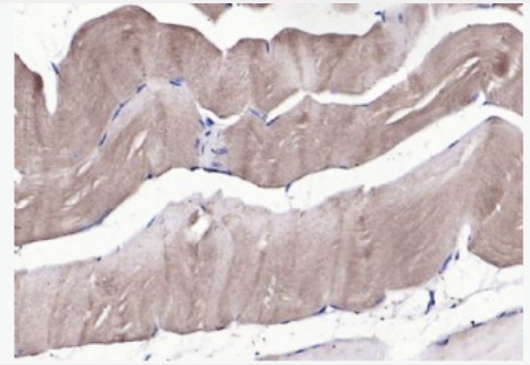 Anti-FGDF8 antibody-生长分化因子8抗体,GDF8