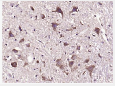 Anti-PMCA3  antibody-ATP酶钙离子转运蛋白PMCA3抗体,PMCA3