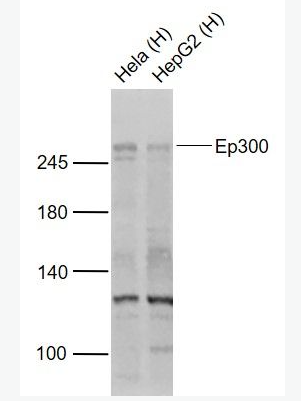 Anti-EP300  antibody-组蛋白乙酰转移酶p300抗体,EP300