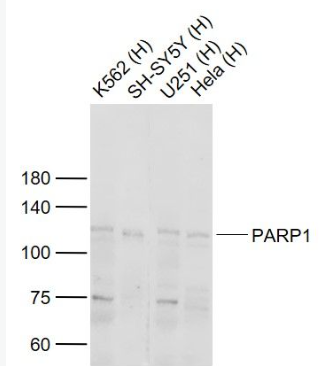 Anti-PARP1 antibody-多腺苷二磷酸多聚酶抗体/多聚ADP-核糖聚合酶1抗体,PARP1