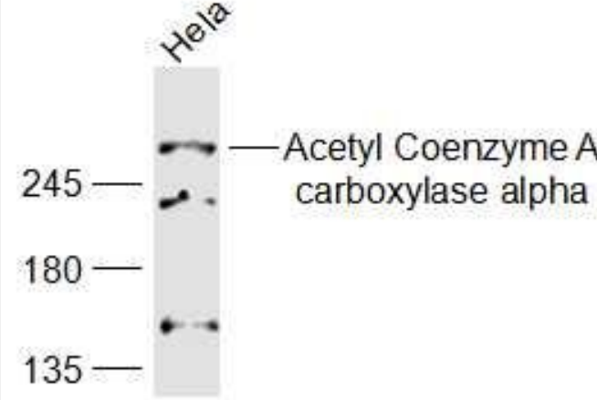 Anti-ACACA antibody-乙酰辅酶A羧化酶1/ACCα抗体,ACACA