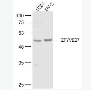 Anti-ZFYVE27 antibody-锌指FYVE结构域蛋白27抗体,ZFYVE27