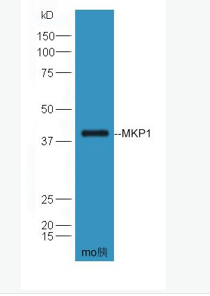 Anti-MKP1 antibody-丝裂原活化蛋白激酶磷酸酶-1抗体,MKP1