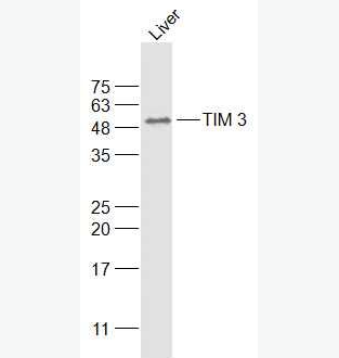 Anti-HAVCR2/TIM-3antibody-T淋巴细胞膜蛋白3（CD366）抗体,HAVCR2/TIM-3