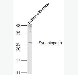 Anti-SYNPR/Synaptoporin antibody-突触囊泡蛋白抗体,SYNPR/Synaptoporin