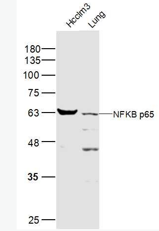 Anti-NFKB p65 antibody-细胞核因子NFKBp65抗体,NFKB p65