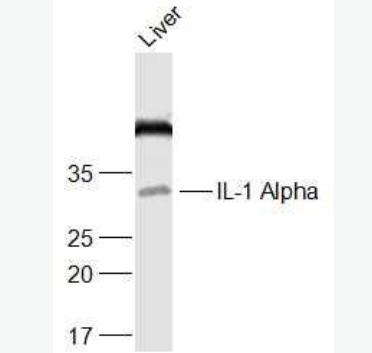 Anti-IL-1 Alpha  antibody-白介素1α/IL-1α抗体,IL-1 Alpha