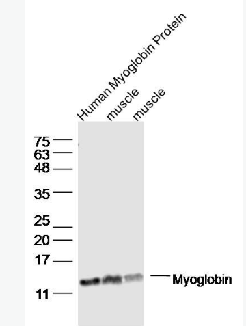 Anti-Myoglobin  antibody-肌紅蛋白抗體,Myoglobin