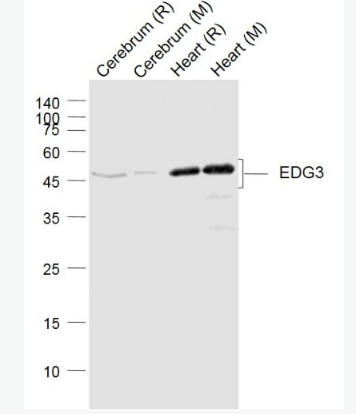 Anti-EDG3 antibody-内皮分化型G蛋白偶联受体3抗体,EDG3