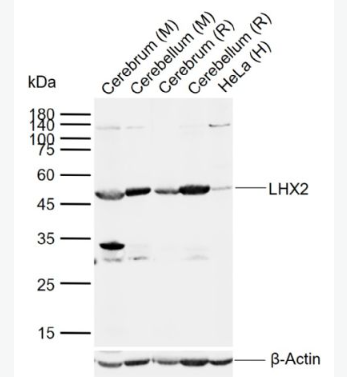 Anti-LHX2 antibody-调控胚胎干细胞分化蛋白Lhx2抗体,LHX2