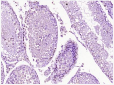 Anti-CTNND1 antibody-连环蛋白delta-1抗体,CTNND1