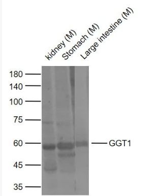 Anti-GGT1 antibody-γ谷氨酰轉(zhuǎn)移酶抗體,GGT1