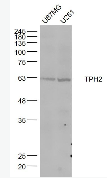 Anti-TPH2 antibody-5色氨酸羥化酶2抗體,TPH2