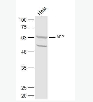 Anti-AFP antibody-甲胎蛋白抗体,AFP