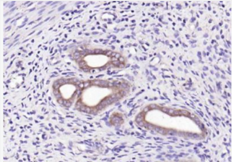 Anti-WNT7B antibody-Wnt蛋白家族7B抗体,WNT7B