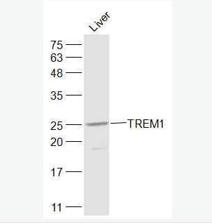 Anti-TREM1 antibody-髓系细胞触发受体1抗体,TREM1