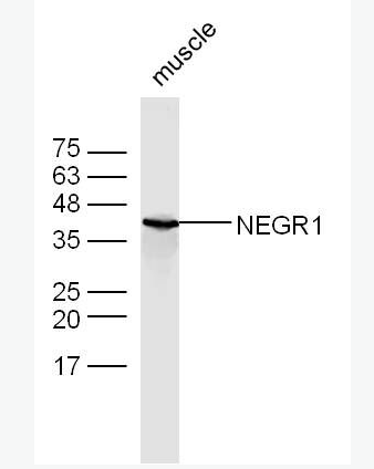 Anti-NEGR1 antibody-神经生长调节蛋白1抗体,NEGR1