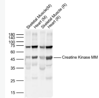 Anti-Creatine Kinase MM antibody-肌酸激酶M型抗体,Creatine Kinase MM