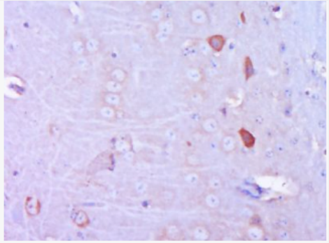 Anti-VGLUT1/BNP1 antibody-脑特异性钠依赖无机磷转运蛋白抗体,VGLUT1/BNP1