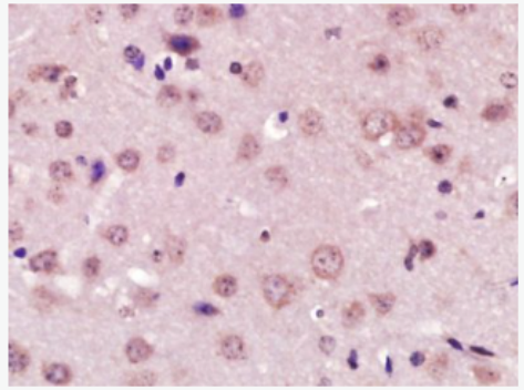 Anti-XPC antibody-DNA补充修复XPC细胞蛋白抗体,XPC