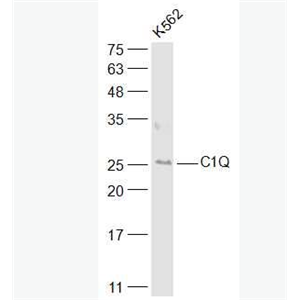 Anti-C1QA antibody-补体C1qα链多肽抗体