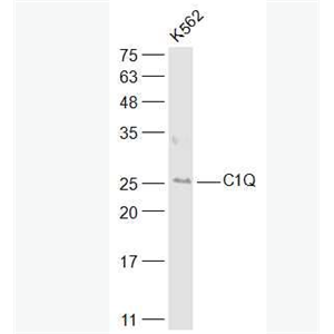 Anti-C1QA antibody-补体C1qα链多肽抗体,C1QA