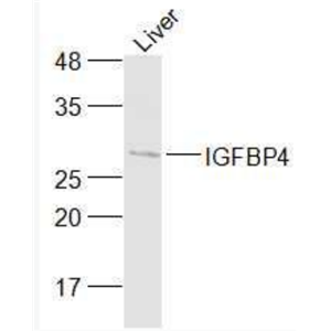 Anti-IGFBP4  antibody-胰岛素样生长因子结合蛋白4抗体
