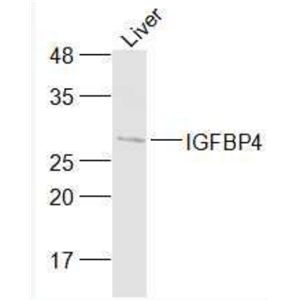 Anti-IGFBP4  antibody-胰島素樣生長(zhǎng)因子結(jié)合蛋白4抗體