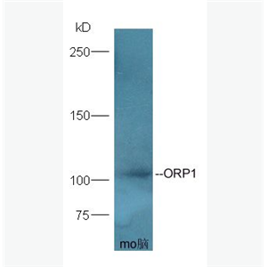 Anti-ORP1 antibody-氧固醇结合蛋白样1A抗体