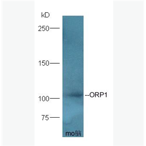 Anti-ORP1 antibody-氧固醇结合蛋白样1A抗体,ORP1