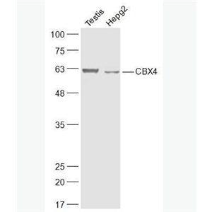 Anti-CBX4 antibody-染色盒同源物4抗体