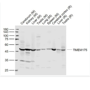 Anti-TMEM175 antibody-跨膜蛋白175抗体,TMEM175