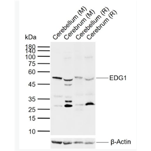 Anti-EDG1  antibody-内皮细胞分化鞘脂G蛋白偶联受体1抗体