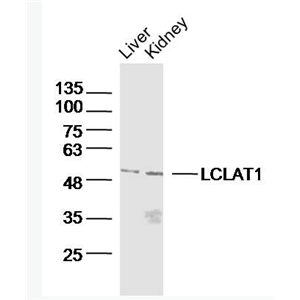Anti-LCLAT1 antibody-心磷脂酰基转移酶1抗体