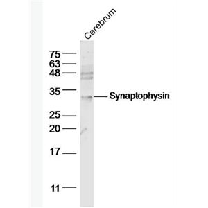 Anti-Synaptophysin  antibody-突觸小泡蛋白P38抗體,Synaptophysin