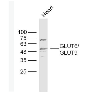 Anti-GLUT6 antibody-葡萄糖转运蛋白6抗体
