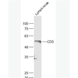 Anti-CD5  antibody-CD5抗体