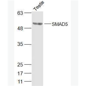 Anti-SMAD5 antibody-细胞信号转导分子SMAD5抗体