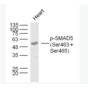 Anti-phospho-SMAD5 (Ser463 + Ser465) antibody-磷酸化細(xì)胞信號(hào)轉(zhuǎn)導(dǎo)分子SMAD5抗體