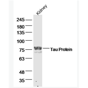 Anti-Tau antibody-微管相关蛋白抗体.