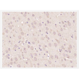 Anti-Nestin antibody-巢蛋白/神经上皮干细胞蛋白抗体,Nestin