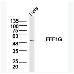 Anti-EEF1G antibody-延伸因子EF-1 γ抗体