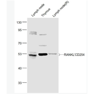 Anti-RANKL/CD254 antibody-骨保护蛋白配体/破骨细胞分化因子抗体.