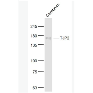 Anti-TJP2  antibody-紧密连接蛋白2抗体,TJP2