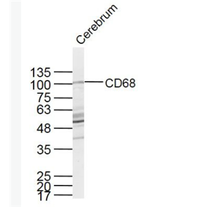Anti-CD68 antibody-CD68抗体