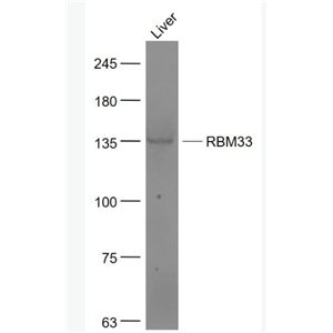 Anti-RBM33  antibody-RNA结合蛋白33抗体